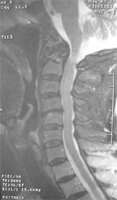 E}`MRI